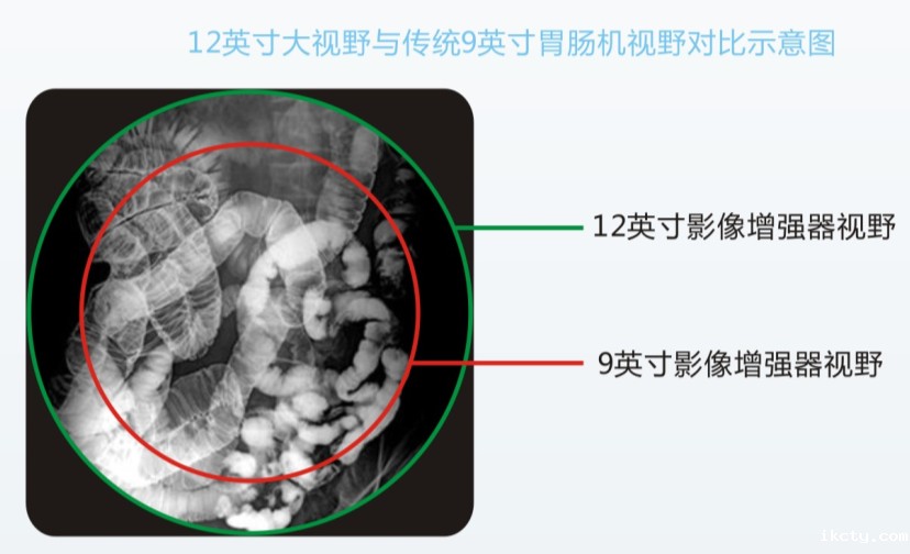 数字胃肠机优势与检查效果