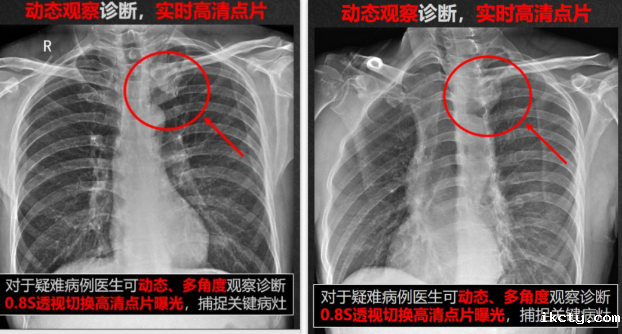 动态dr