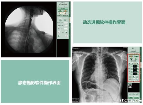 动态dr