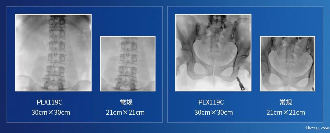 移动式平板C臂视野