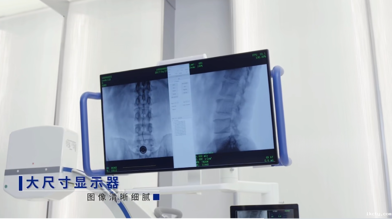 一体式移动C形臂大尺寸显示器