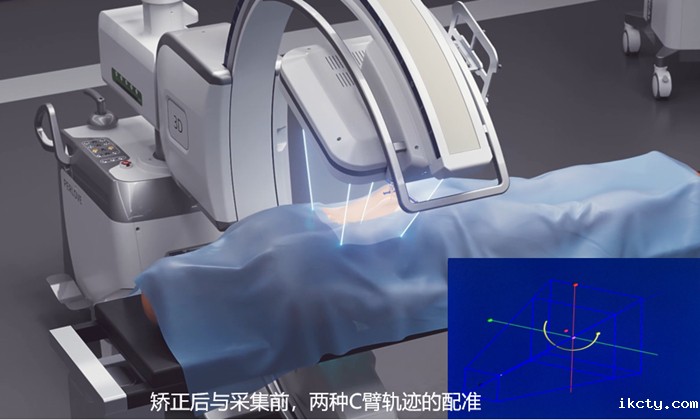 骨科手术导航定位系统