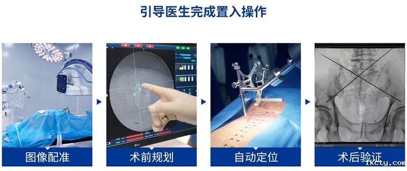 骨科手术机器人标准化流程