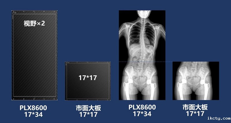 儿童DR拍片不拼接
